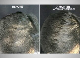 Regenerative Medicine & PRP (Platelet Rich Plasma)