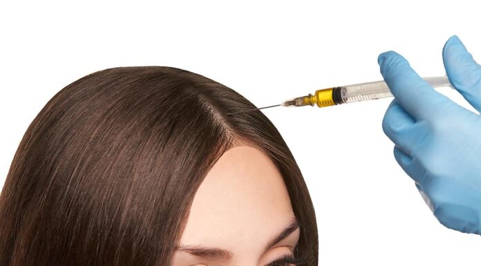 Medical options for hair loss