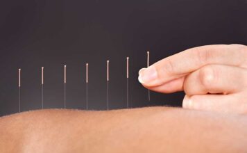 Acupuncture for All acupuncture