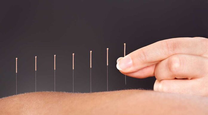 Acupuncture for All acupuncture