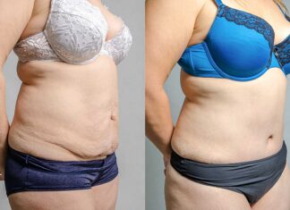 Lose that tummy BEFORE the holidays, not after!