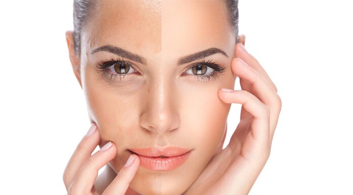 How to take care of your skin during the winter