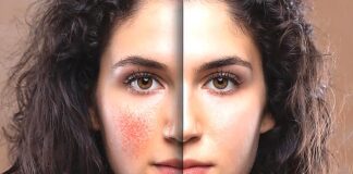 The Power of PRF and Benev Exosomes: Transforming Skin & Hair Health