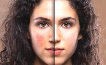 The Power of PRF and Benev Exosomes: Transforming Skin & Hair Health