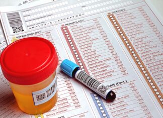 Why I Don’t Suggest Direct-to-Consumer Labs