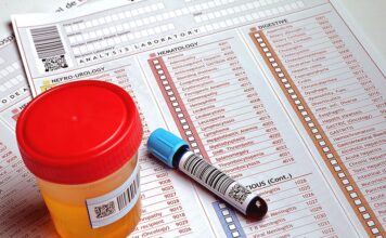 Why I Don’t Suggest Direct-to-Consumer Labs