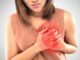 Looking Beyond Cholesterol: Advanced Cardiovascular Testing for Women